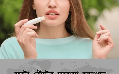 ঠোঁট ফাটার যন্ত্রণা থেকে মুক্তির ৫টি ঘরোয়া কৌশল (সব বয়সিদের জন্য প্রযোজ্য!)