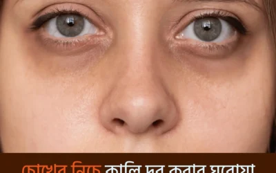 চোখের নিচের কালি দূর করতে চাইছেন? এই ঘরোয়া উপায়গুলোই হতে পারে আপনার জাদুর চাবিকাঠি!