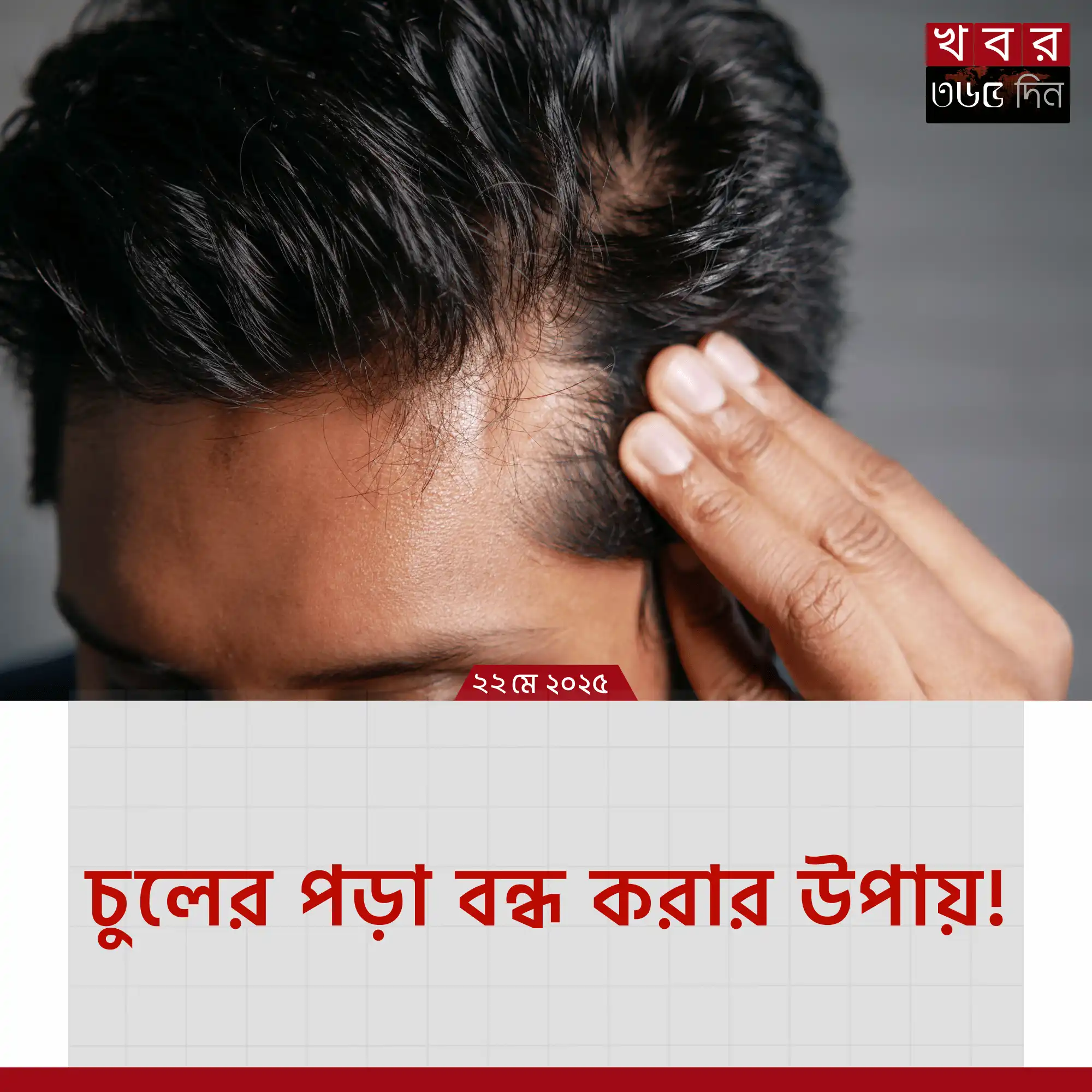চুলের পড়া বন্ধ করার উপায় নিয়ে সচেতনতা