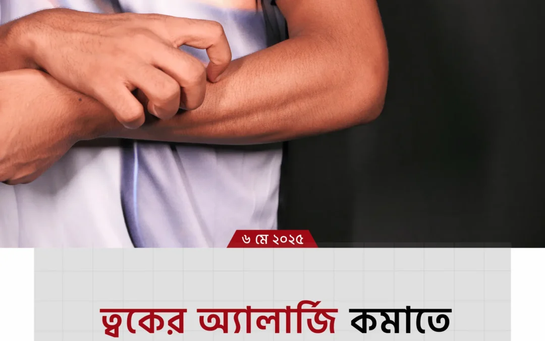 অ্যালার্জি থেকে মুক্তির ৯টি ঘরোয়া উপায় – সহজেই চুলকানি ও ফুসকুড়ি কমান!