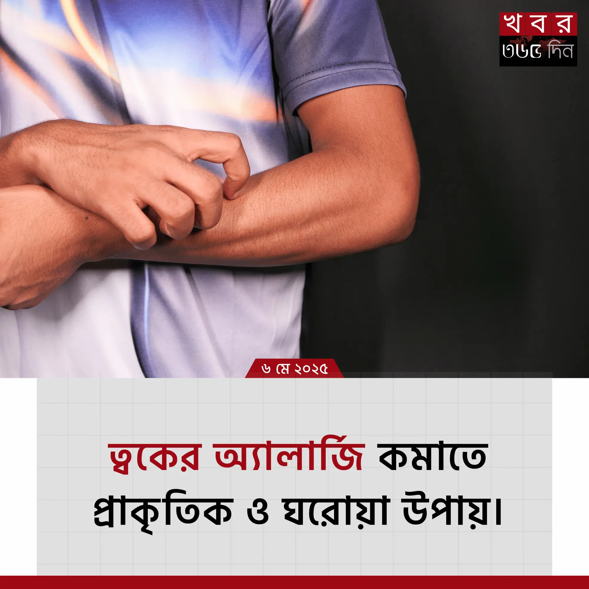 চর্ম অ্যালার্জির ঘরোয়া চিকিৎসা ও প্রতিকার