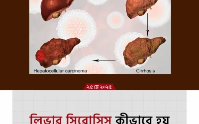 liver cirrhosis: লিভারের নীরব ঘাতক, জানুন কারণ, লক্ষণ ও প্রতিকার